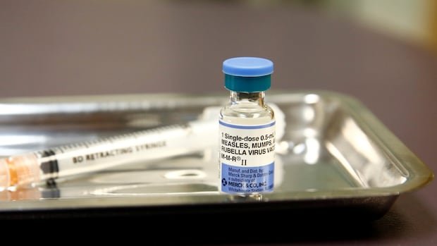 Ontario urging measles vaccinations amid worst outbreak in more than a decade