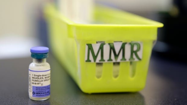 Ontario measles cases more than double over last 2 weeks, 31 hospitalizations reported