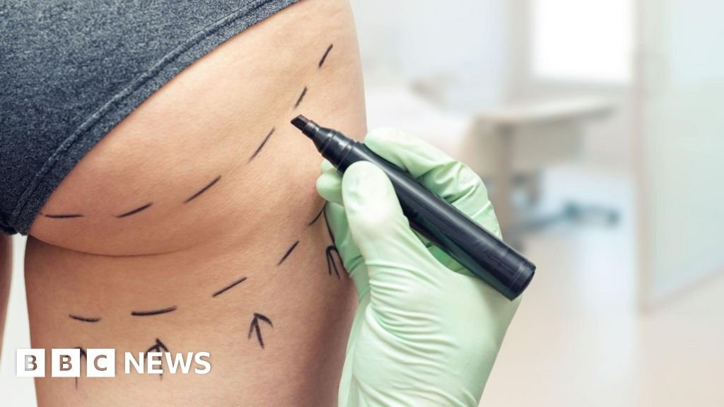 Brazilian butt lift ads banned by UK regulator