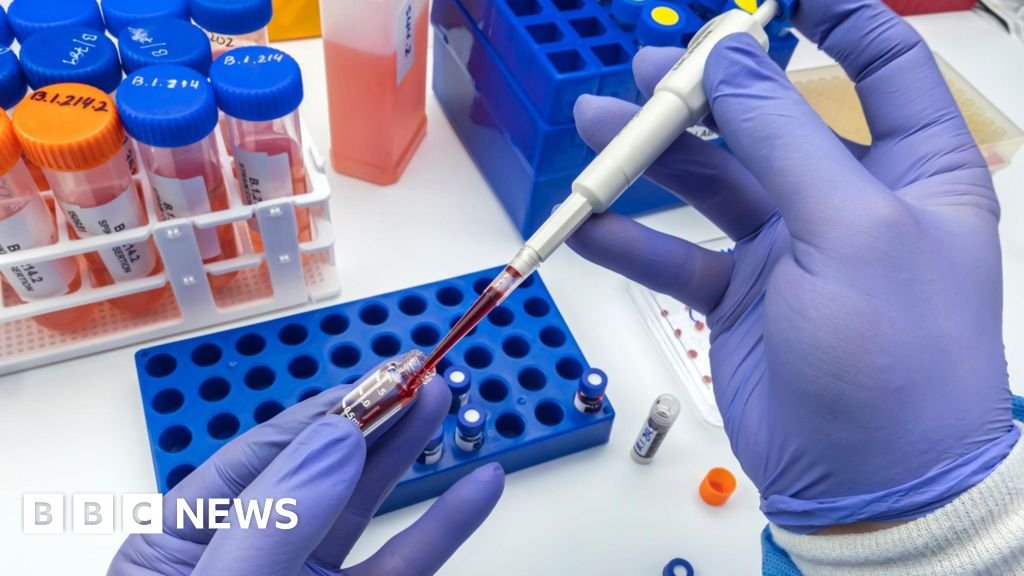 Blood test firm blamed by GPs for ‘catalogue of disasters’