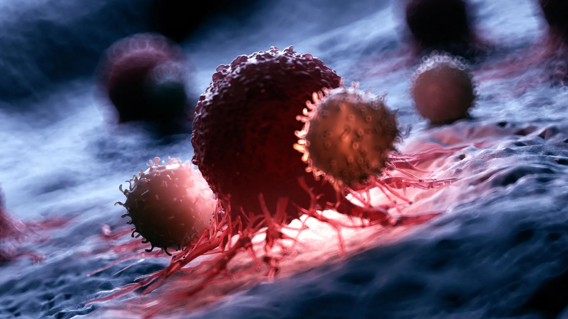 Doctors just found a way to slow one of the deadliest prostate cancers