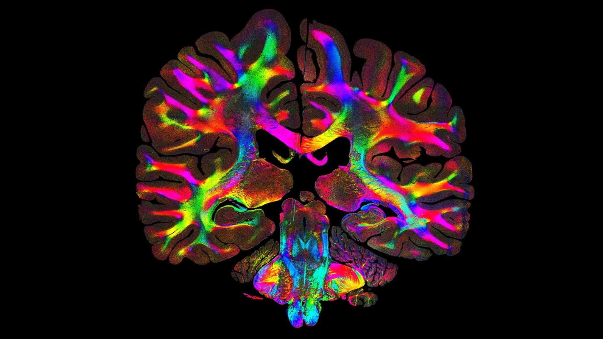 Simple light trick reveals hidden brain pathways in microscopic detail