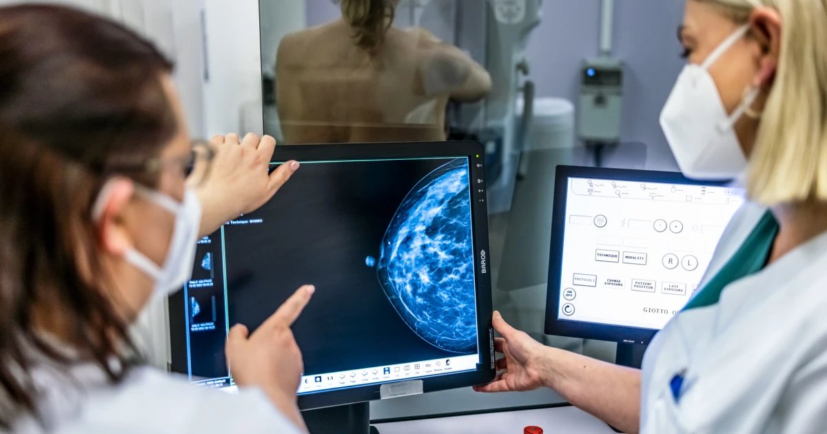 Can a mammogram detect heart disease? What to know about breast calcium deposits