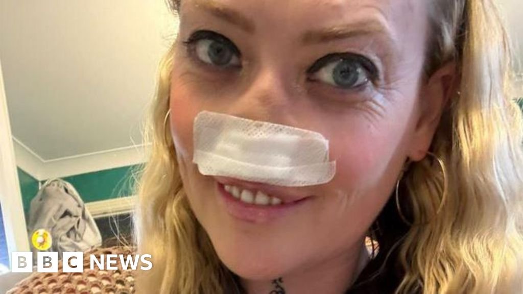 Telford botched “Turkey teeth” op victim keeps going advising of dangers