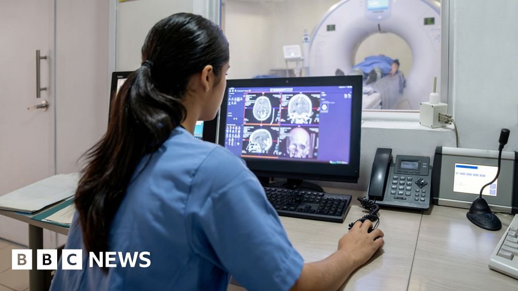 Menopause linked to Alzheimer’s-like brain changes