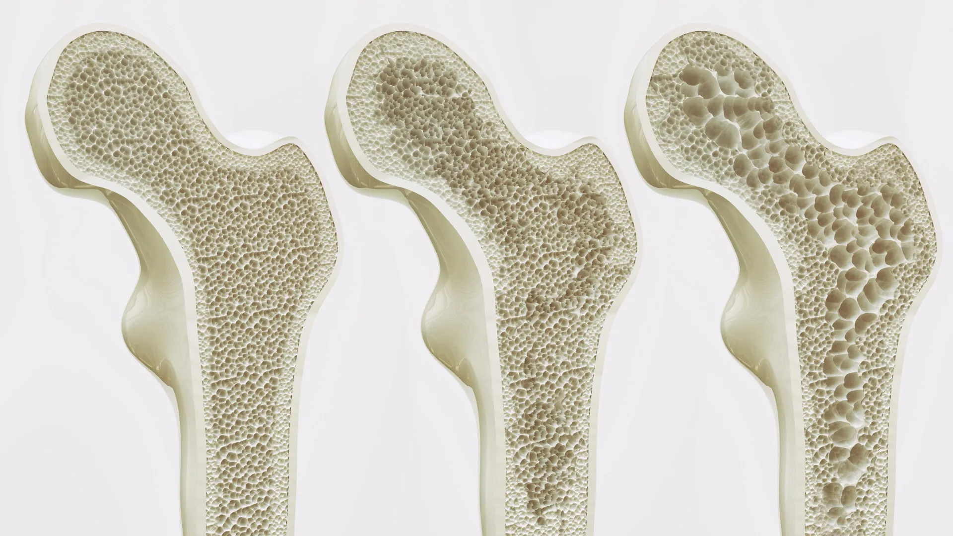Scientists may have found a way to keep your bones strong for life