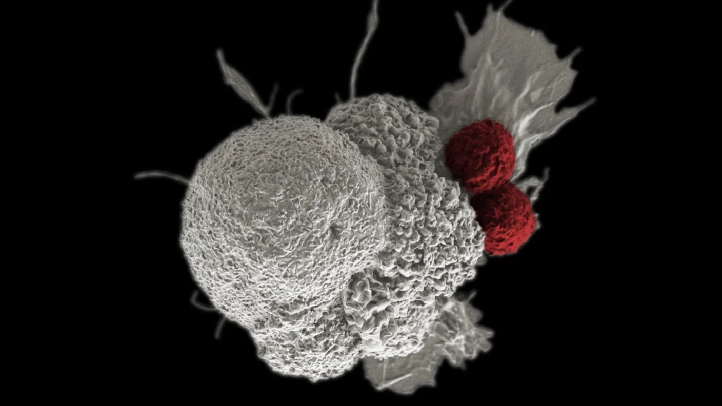 In First Human Trial, Zombie Cancer Cells Train the Body to Fight Tumors
