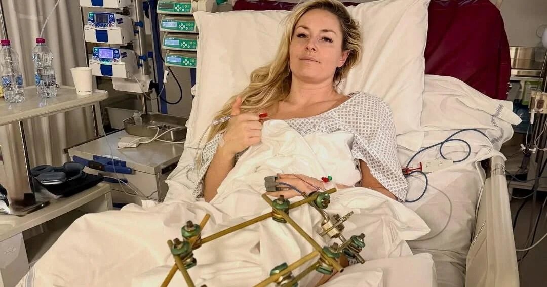 Lindsey Vonn says surgery saved her leg from amputation after Olympics crash