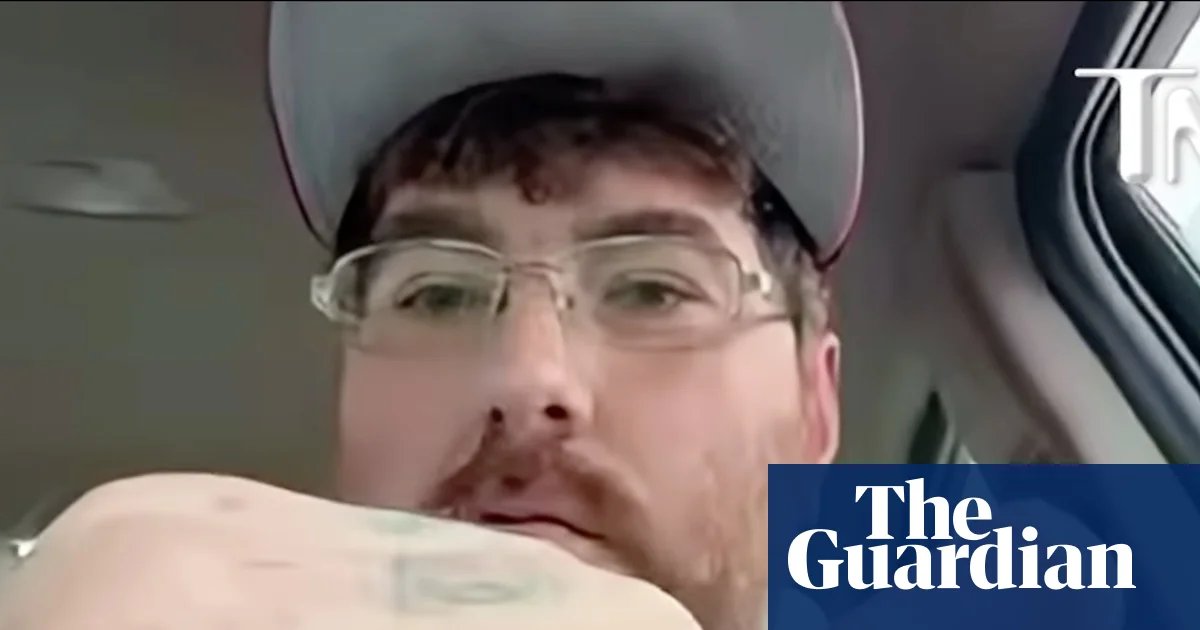 US man issues challenge to disprove his claim of having world’s smallest penis to raise micropenis awareness | North Carolina