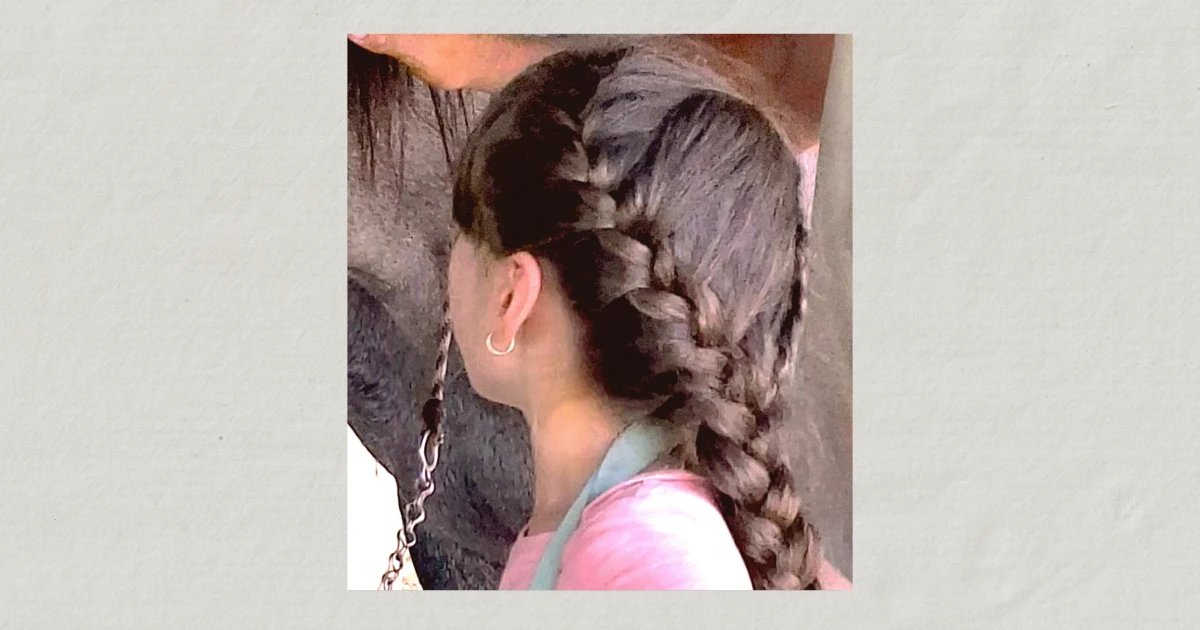 After a year in Mexico, recovery has stalled for U.S. citizen girl with rare brain tumor, deported mother says