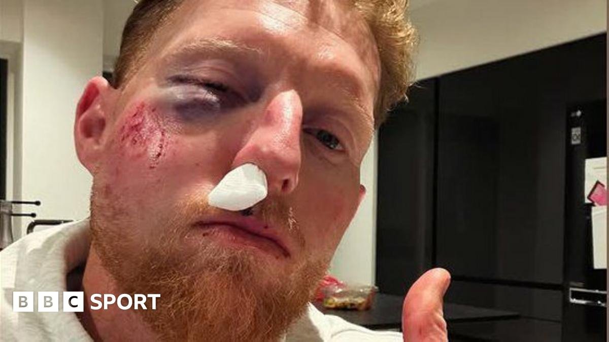 Ben Stokes: England Test captain suffers facial injury after being hit by ball while coaching
