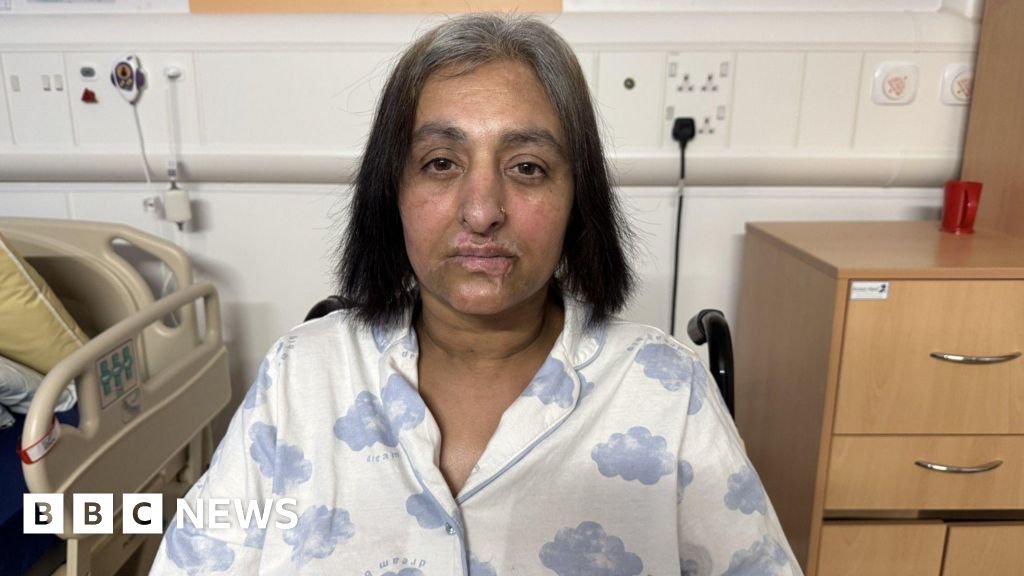 Sepsis warning after woman's quadruple amputation