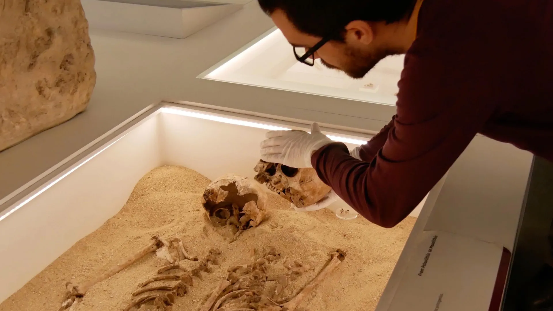 Ancient DNA solves 12,000-year-old mystery of rare genetic growth disorder