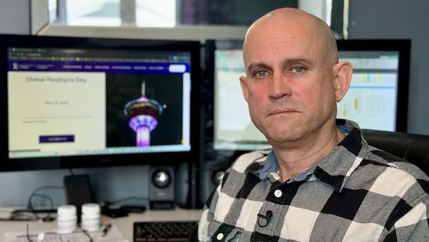 Rare sun disorder kept Saskatoon man indoors for decades until a clinical trial changed everything