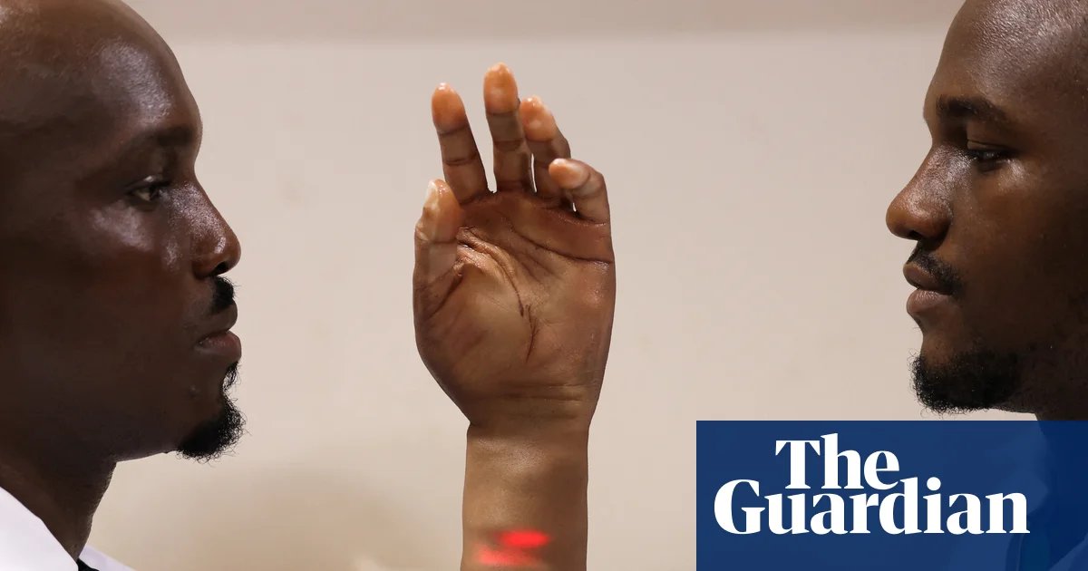 ‘Prosthetics aren’t made for people like us’: the brothers creating innovative artificial limbs for Africans | Global development