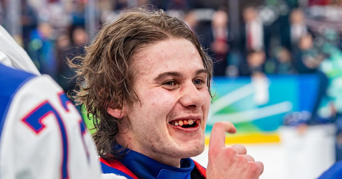 U.S. Olympic hockey hero Jack Hughes finally fixes teeth broken in gold medal game