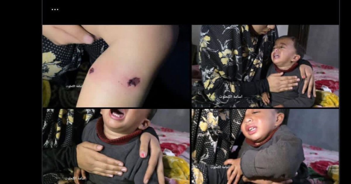 The IDF are the Nazis now. Funny how that works…