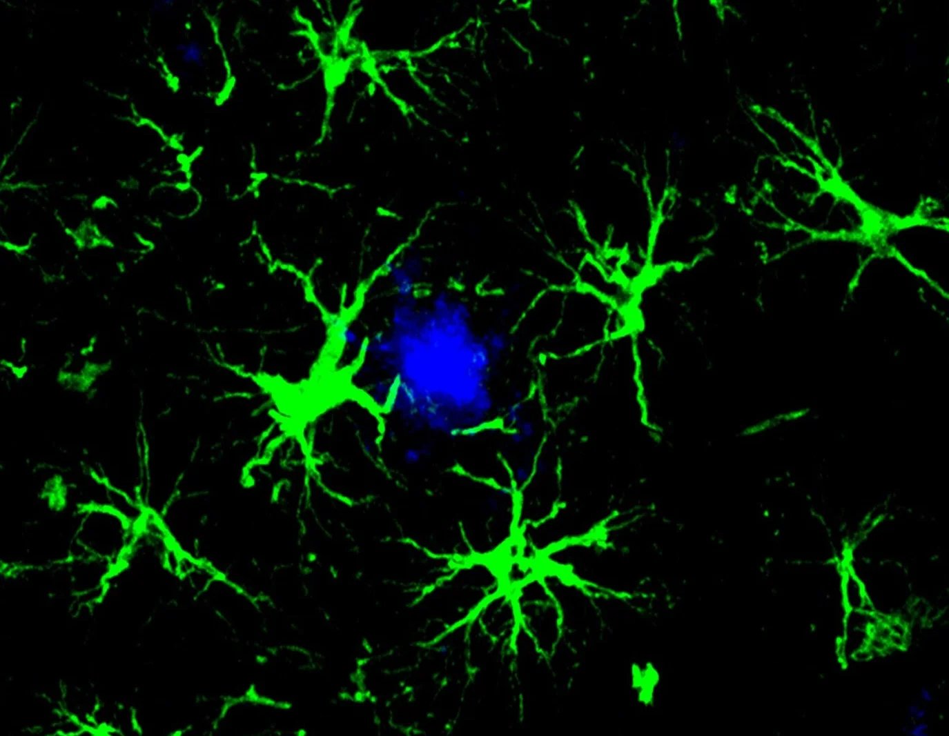 These Genetically Engineered Brain Cells Devour Toxic Alzheimer’s Plaques