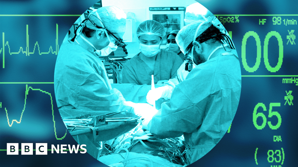 UK's transplant system was world-leading – now it lags behind other Western nations