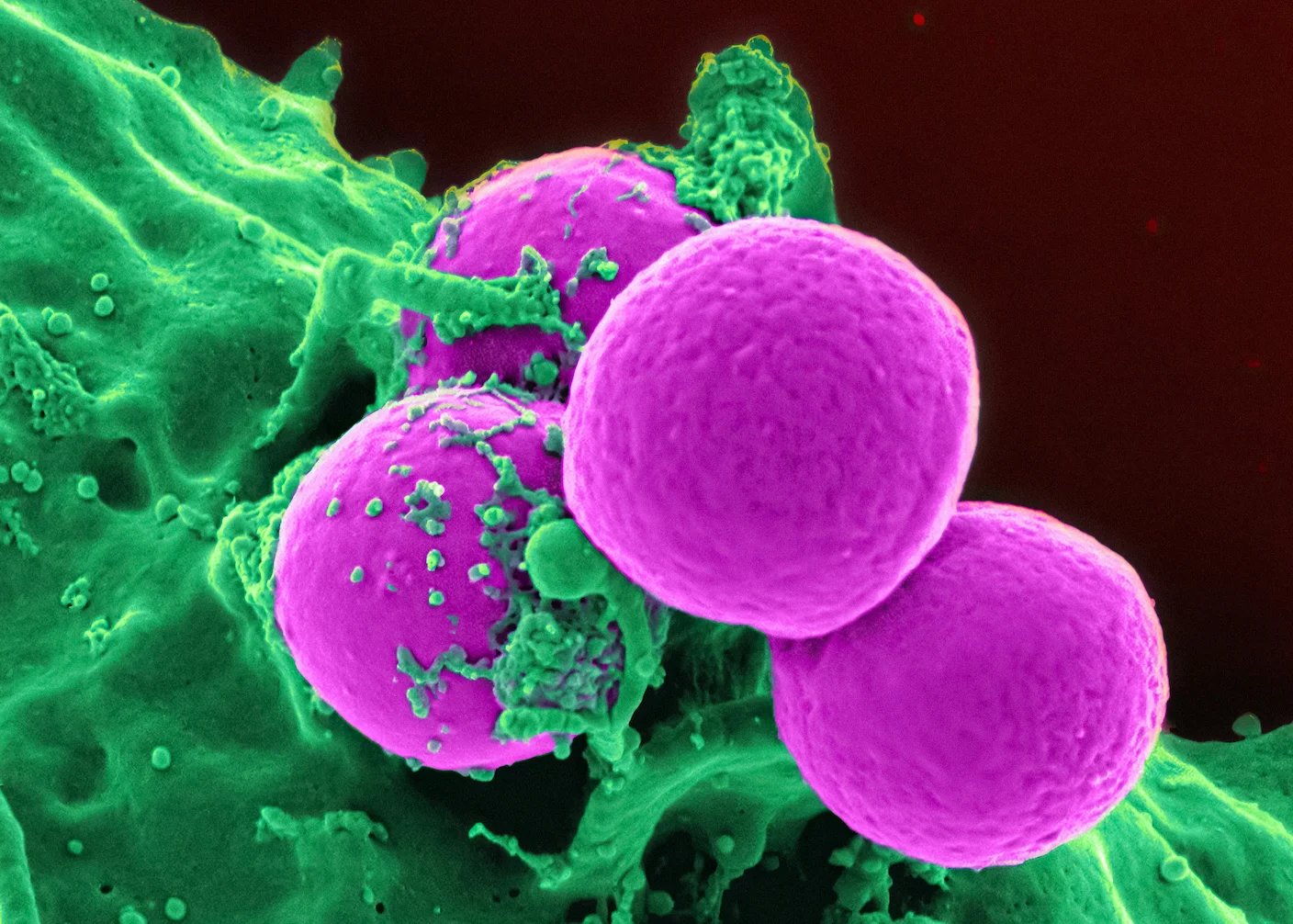 These Killer Cells Wipe Out Deadly Superbugs in a Day
