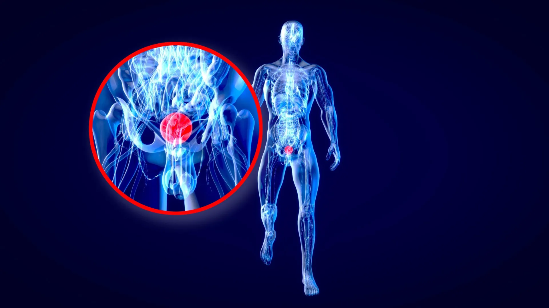 Stanford scientists say colorblindness may hide a deadly bladder cancer warning