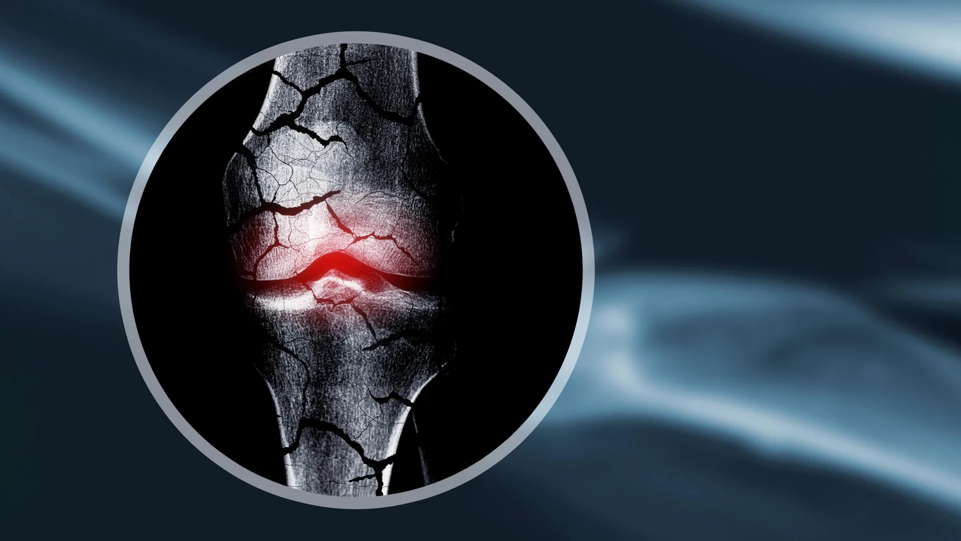 Scientists create cartilage scaffold that helps the body regrow bone