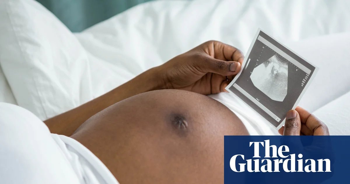 Stress from racism may help explain why black women more likely to die in childbirth, study finds | Women’s health