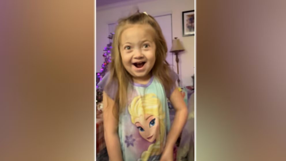 WATCH:  Girl with rare disease spreads joy