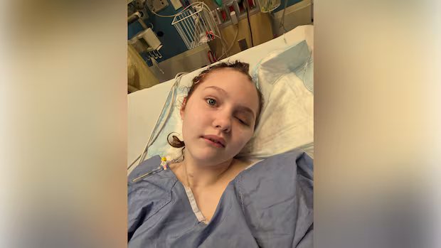 Tumbler Ridge shooting survivor’s 5th surgery ‘a success,’ father says