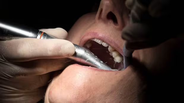 Man denied dental coverage under national plan says insurer ‘playing games’ with Canadians