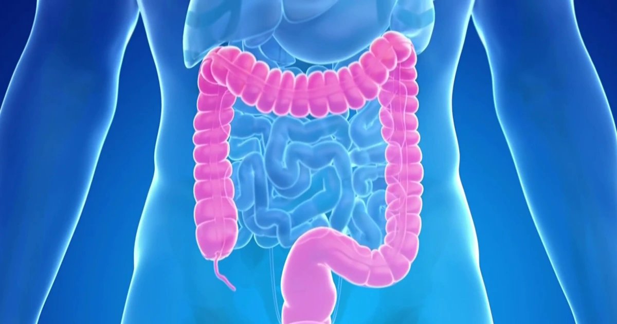 New blood test is added an an option for colorectal cancer screenings