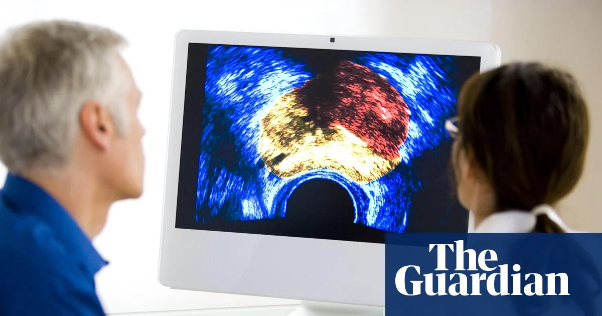Fewer men should get prostate cancer screening, committee recommends | Prostate cancer