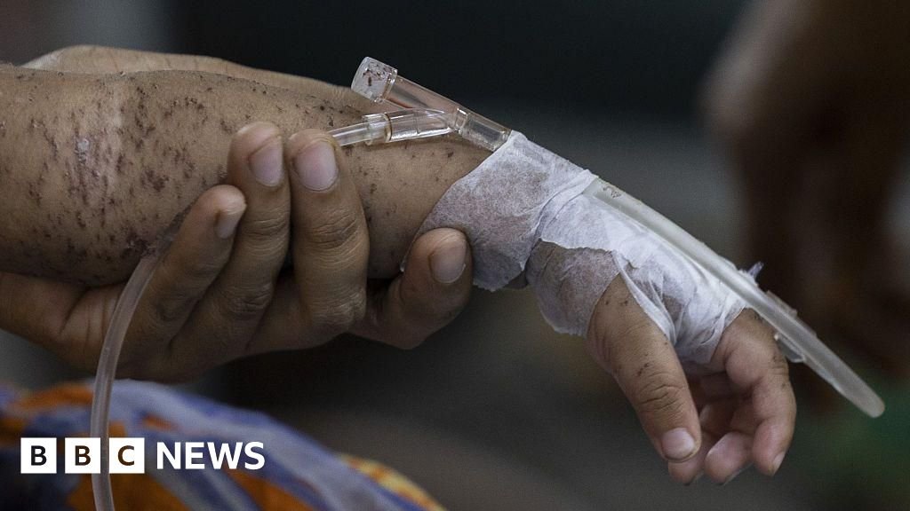 Bangladesh measles cases: Hundreds of children die within months