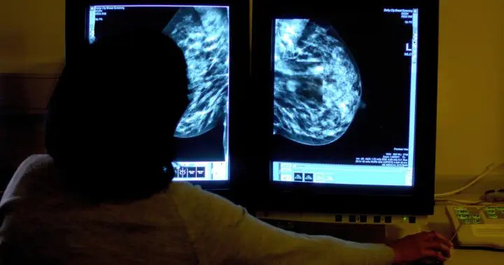Nova Scotia Opposition says wait for mammograms shouldn’t be more than a year – Halifax