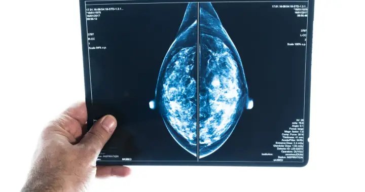 These are the Canadian regions with the highest rates of breast cancer – National