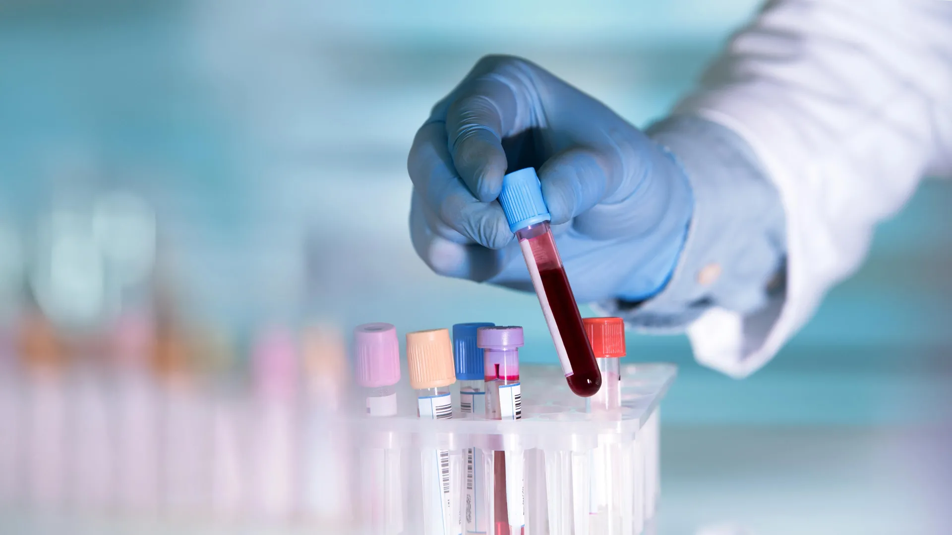 This simple blood test might detect depression before symptoms appear