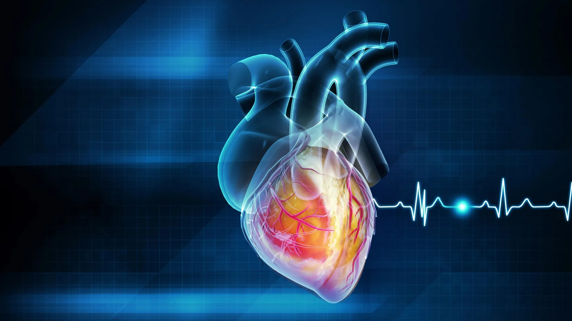 Popular GLP-1 weight-loss drugs like Ozempic slash heart attack and stroke risk