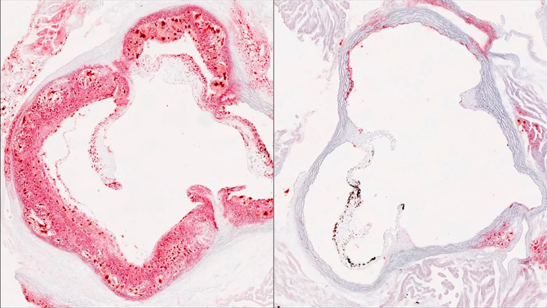 Scientists discover hidden liver switch that cuts harmful cholesterol