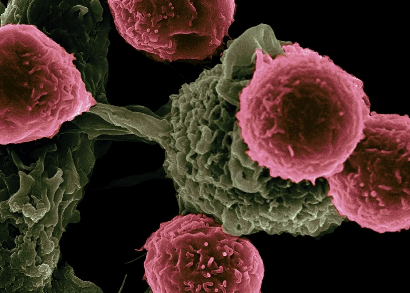 A Revolutionary Cancer Treatment Could Transform Autoimmune Disease