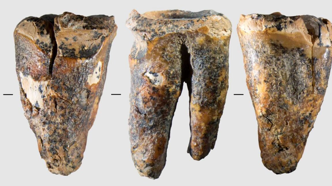 Neanderthals drilled cavities to treat a toothache 59,000 years ago