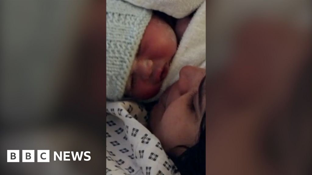 1 in 4 births in England now by emergency C-section