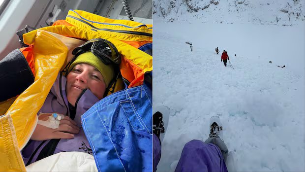 B.C. woman who survived avalanche says it was like ‘being hit by a truck’
