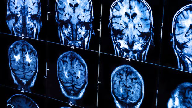 Women with traumatic brain injury 26 per cent less likely to receive trauma care than men, Ontario study finds
