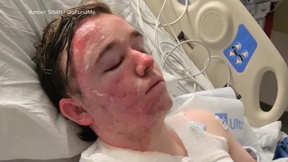 WATCH: Northern California McDonalds worker burned in alleged oil attack