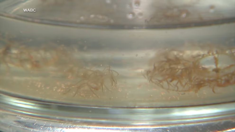 WATCH:  Scientists warn of invasive jellyfish on East coast