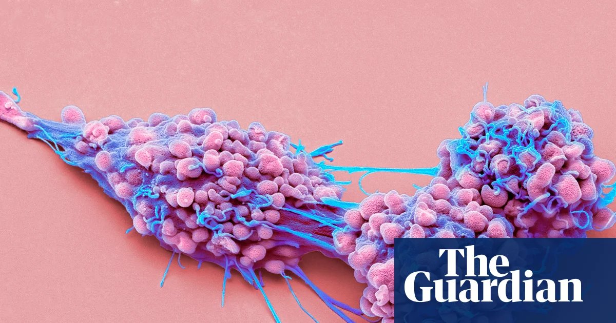 Life-prolonging drug for advanced ovarian cancer gets go-ahead in England | Ovarian cancer