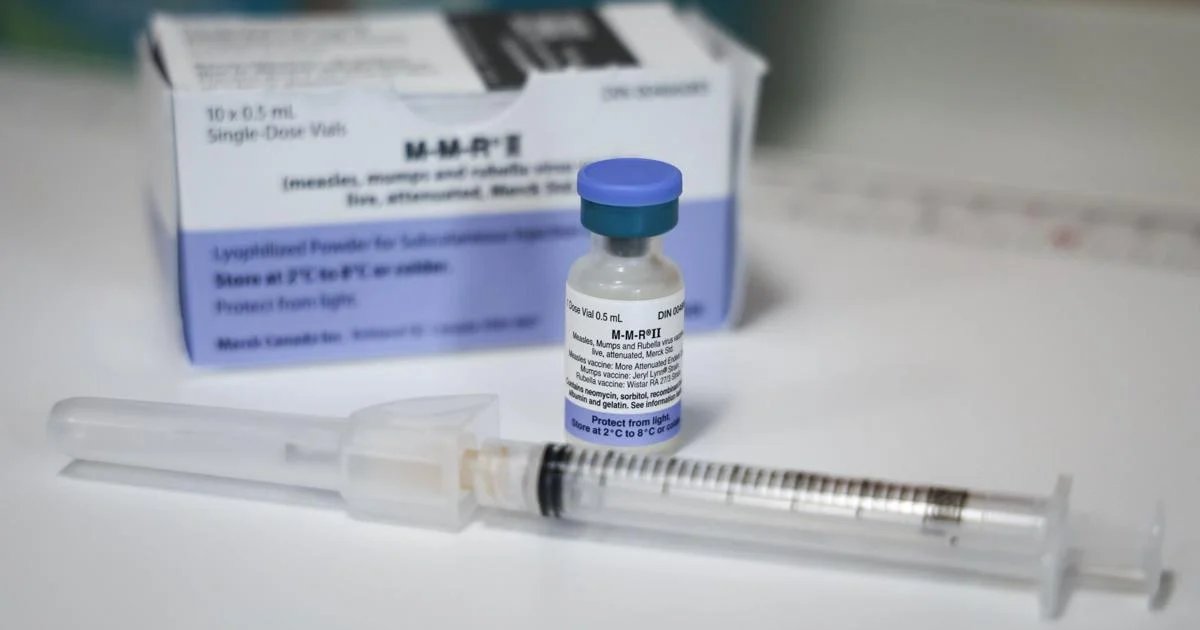 4 mumps cases as outbreak declared at ServiceOntario downtown Toronto head office