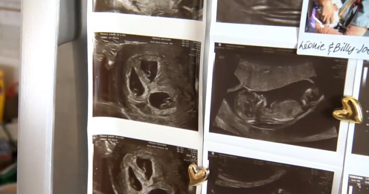 Quebec single mother welcomes triplets after years of fertility struggles – Montreal