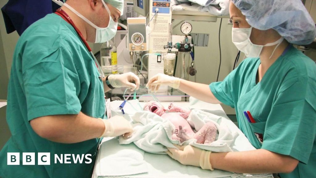 One in four births in England are now emergency caesareans, BBC analysis shows