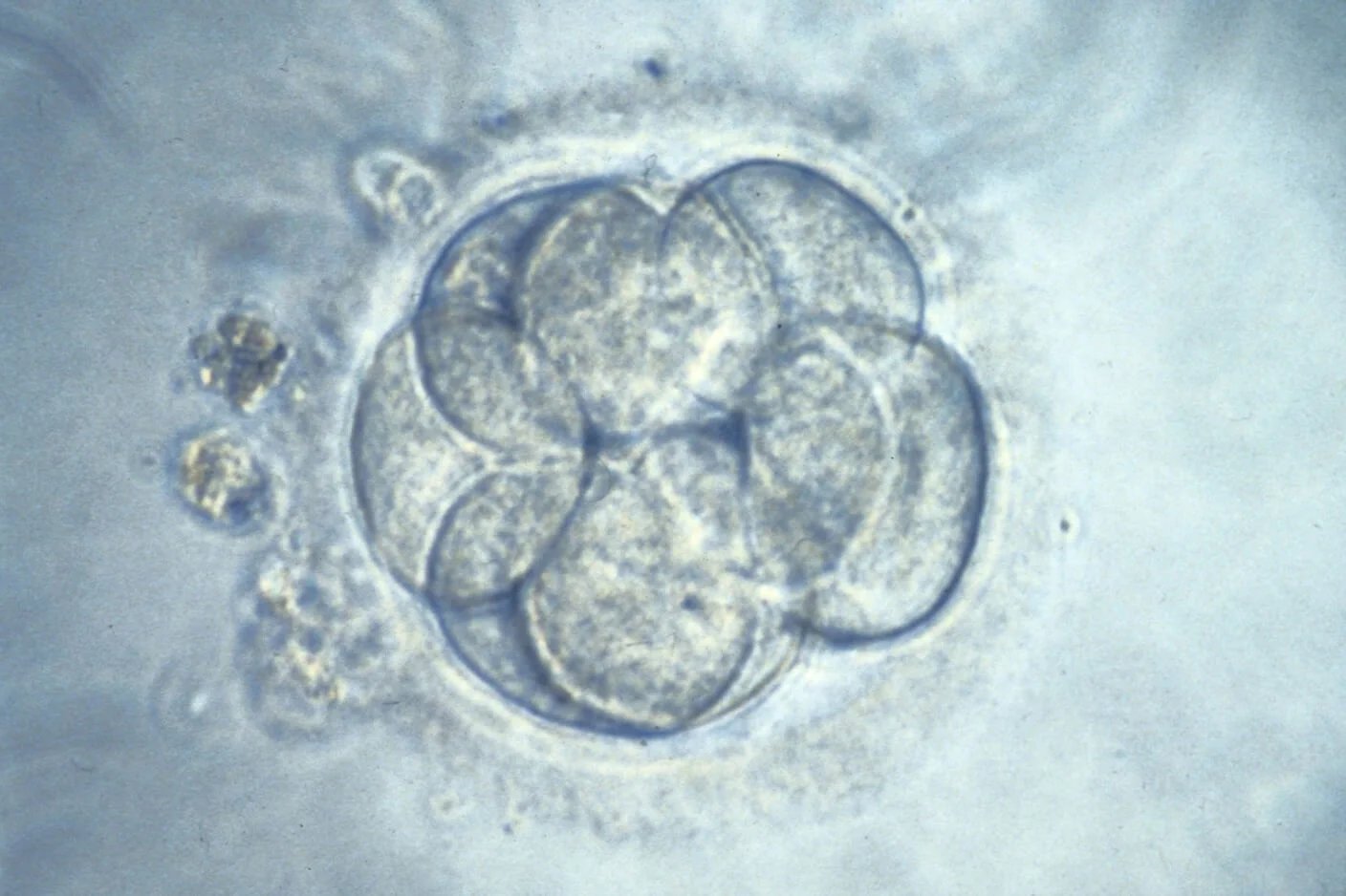 Precise Gene Editing in Early Human Embryos Reignites the ‘Designer Baby’ Debate